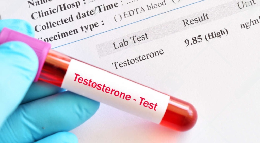 testosteron normy