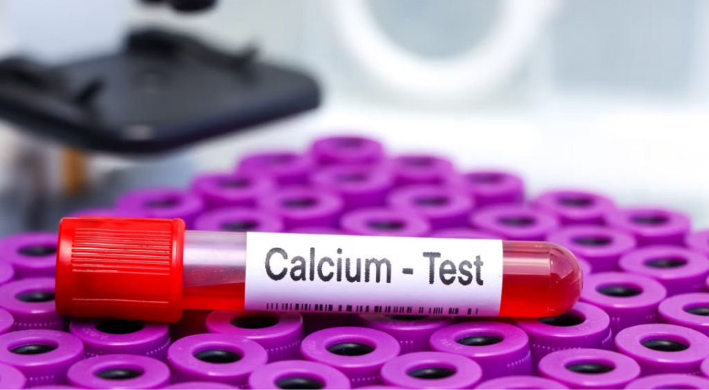 wapń całkowity normy